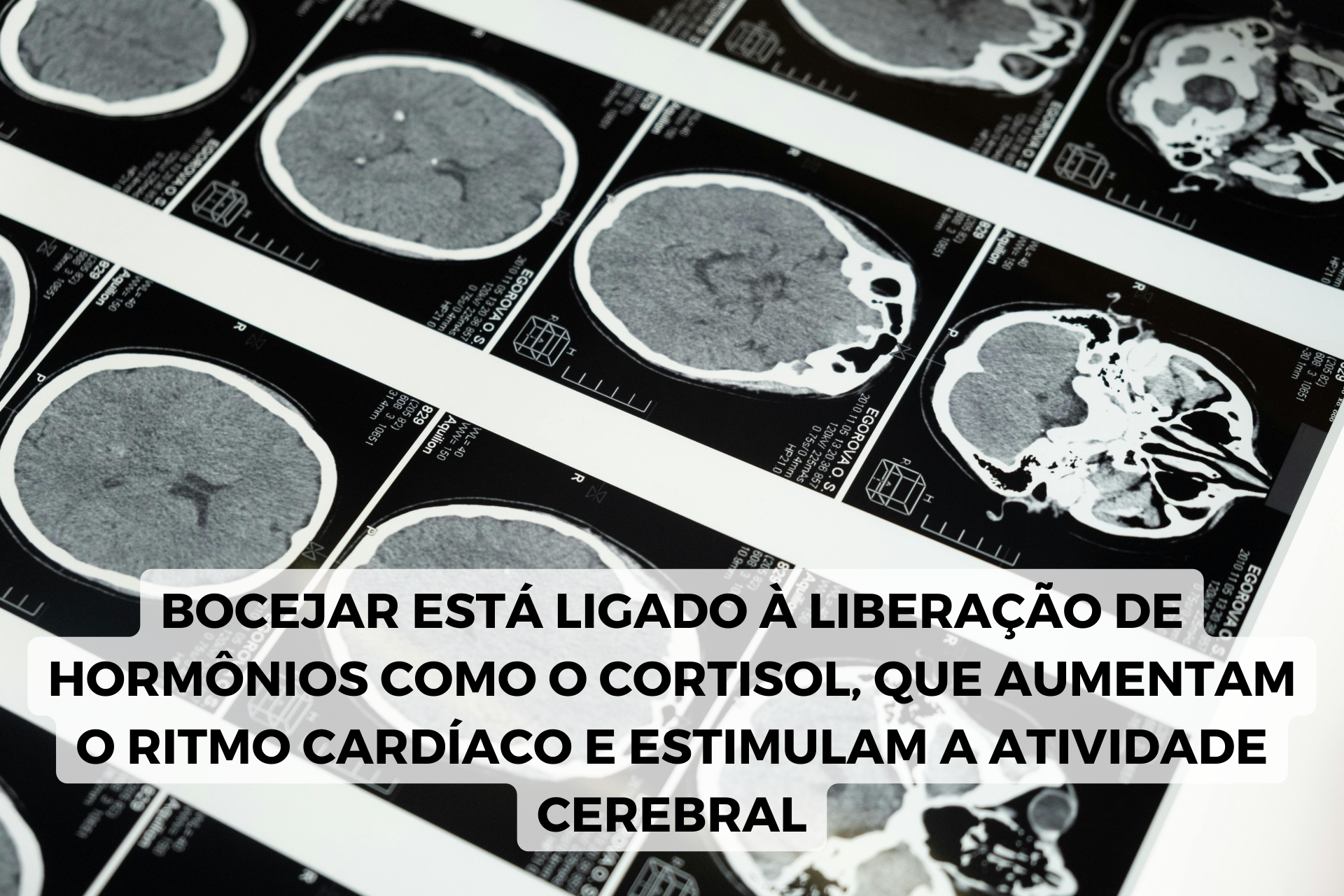 bocejar e cortisol